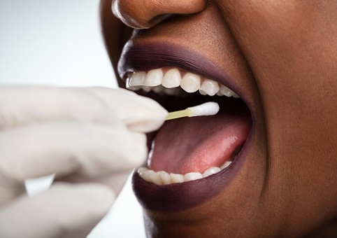 Close up of a mouth being swabbed